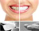 Slider image (8) Dentart Implant and Aesthetic Dentistry